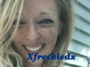 Xfreckledx